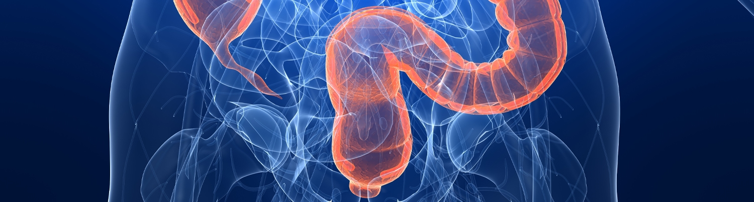 Chirurgie colorectală