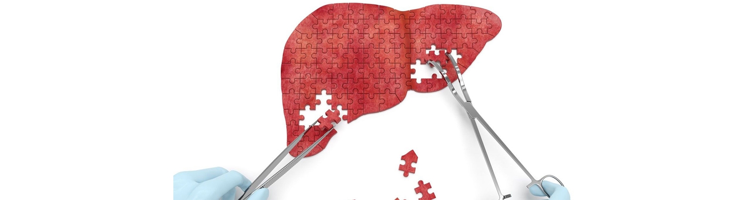 Chirurgie hepatobiliară